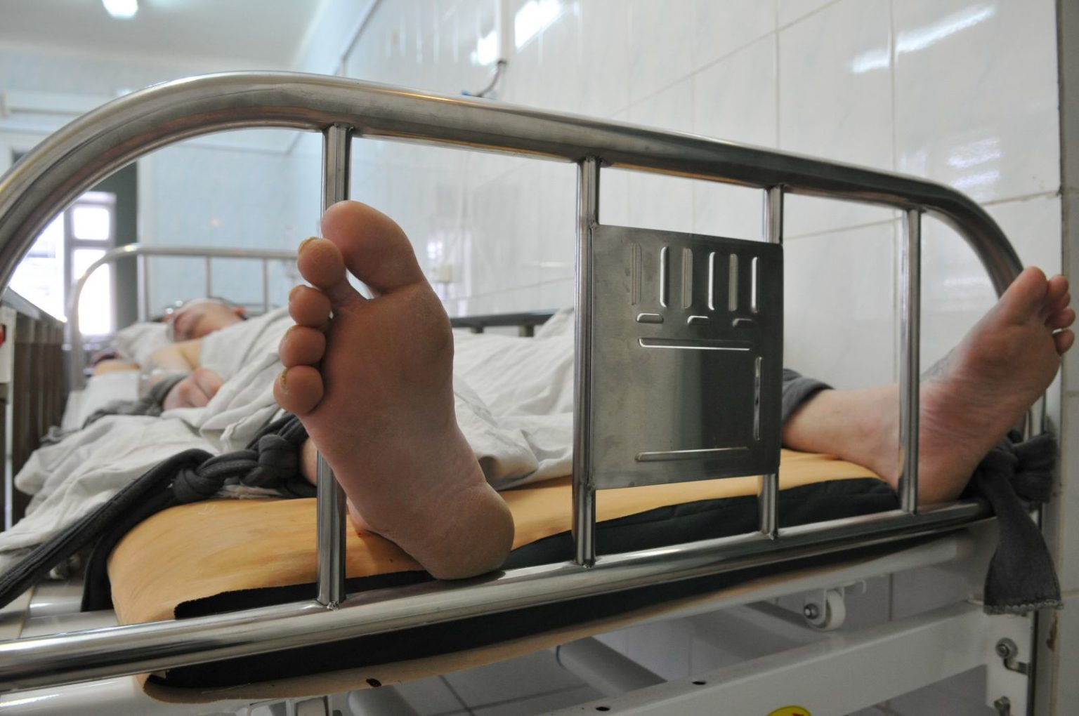 Прикованный к кровати в больнице